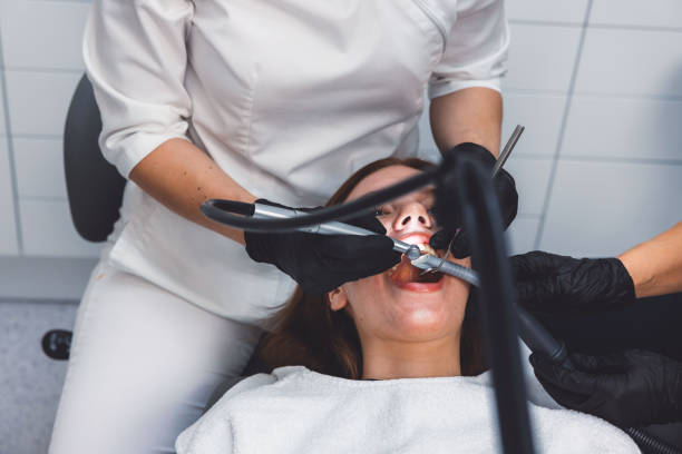 Best Emergency Root Canal Treatment in Gasport, NY